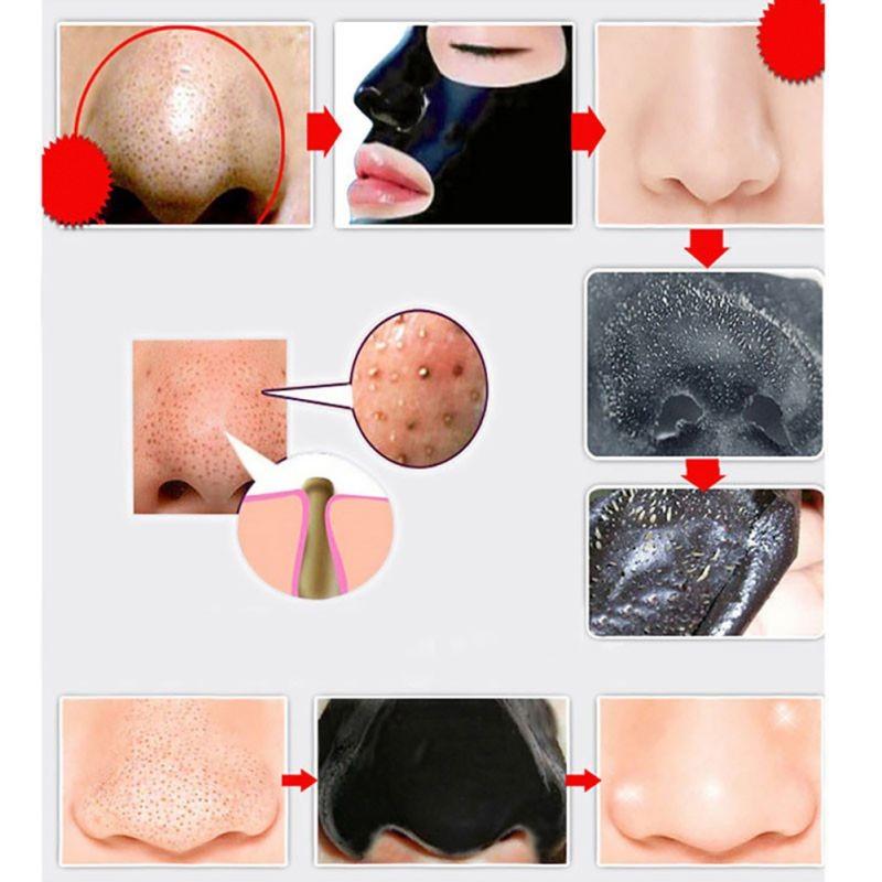 Amazing Blackhead Removal Deep Cleaning Face Mask It's WONDERFUL